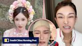 Deformed China trans KOL shocks fans after botched US$183,000 plastic surgery