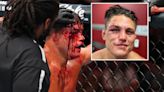 Watch UFC star bravely carry on fighting despite huge 'gross' cut to his eye