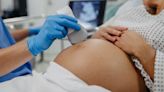 Serious maternal complications linked with use of marijuana before and early in pregnancy, study says