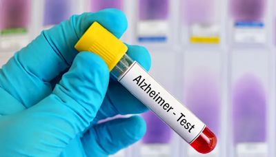 Blood tests for Alzheimer's may be coming to your doctor's office. Here's what to know - ET HealthWorld