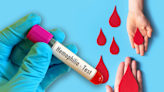 UNAM: ¿Qué es la hemofilia y cómo afecta la coagulación?