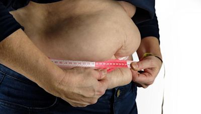 雲林過重人口占46.8％！醫警BMI超過24是「病態肥胖」需就醫