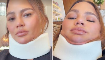 Chrissy Teigen Models a Neck Brace and Jokes She Skipped the 2024 Met Gala Because a Headstand 'Didn’t Go Well'