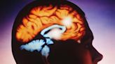 Surgery targeting brain region may relieve tough-to-treat epilepsy