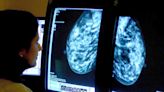 New breast cancer treatment not approved for NHS use