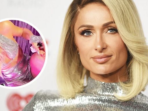 Paris Hilton sufrió una lesión de rodilla mientras filmaba su nuevo video musical