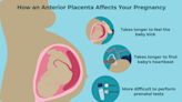 What Is an Anterior Placenta?