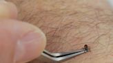 The Best Way to Remove a Tick? Use This Two-Sided Tool