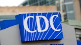 CDC confirms HIV infections linked to 'vampire facials'