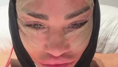 Katie Price left 'looking like an octopus' after surgery and was crying out in agony, says ex Carl Woods