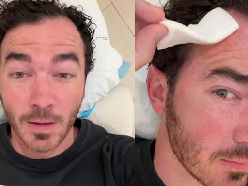 Jonas Brothers' Kevin Jonas Diagnosed With Skin Cancer? Singer Makes Shocking Health Revelations; WATCH Video