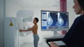 Why US experts are now recommending breast cancer screenings for women in their 40s