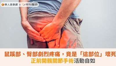 鼠蹊部、臀部劇烈疼痛，竟是「這部位」壞死！正前開髖關節手術活動自如 | 蕃新聞