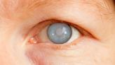 ¿Cómo detectar el glaucoma a tiempo?