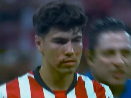 VIDEO: Brutal codazo de Alexis Vega que dejó sangrando a Érick Gutiérrez en el Chivas vs Toluca