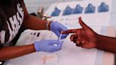 Male HIV infections dropped by 12 percent in 2022: CDC