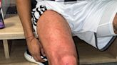 Video: la patada que hirió la rodilla de Zaracho