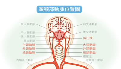 吸菸和三高是危險因子！健檢發現頸動脈狹窄怎麼辦？是不是很嚴重？會不會中風呢？