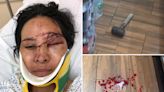 NYC bodega worker describes vicious hammer attack that left her blacked out, battered: ‘I’m afraid now’