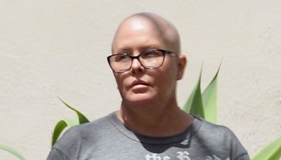 Baywatch star Nicole Eggert, 52, shows shaved head amid breast cancer battle