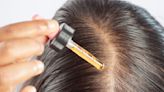 Experiencing Hair Loss At The Crown? Doctors Say To Add These 5 Natural Hair Oils To Your Routine To Stop Shedding