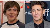 Zac Efron says he 'almost died' in the severe accident that shattered his jaw and led people to speculate he'd had plastic surgery