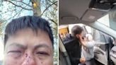 Melbourne father allegedly attacked after confronting car thief