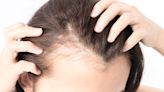 Top Dermatologists Say This Common Sleep Aid Can Also Reverse Thinning Hair