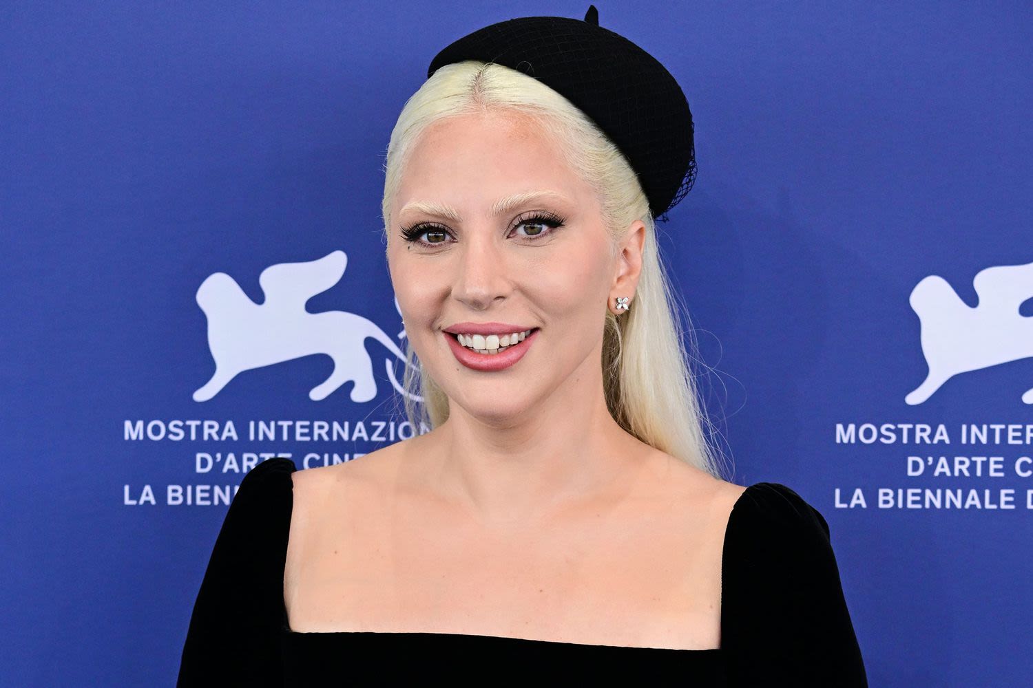 Lady Gaga Says She's 'Pain-Free' and Hasn't 'Smoked Pot in Years' amid Chronic Disorder