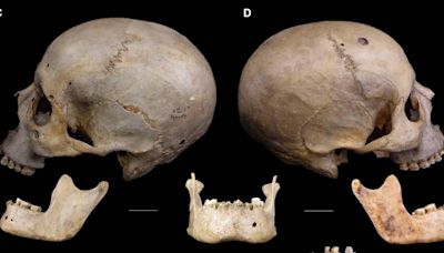 El cráneo de 4.000 años de antigüedad que revela cómo los egipcios trataron de operar el cáncer