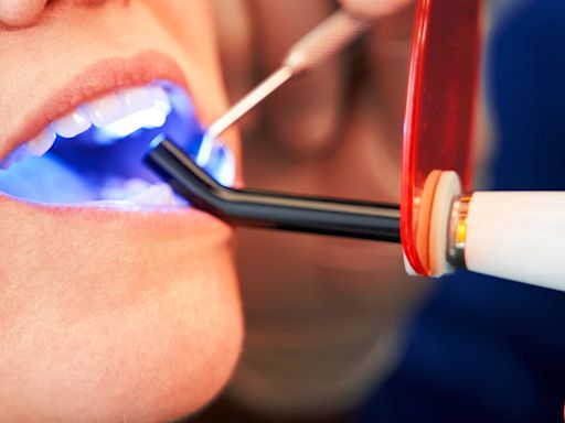 Teeth Whitening Buffalo Unveils Innovative “Smile Transformation Program” to Elevate Dental Health and Confidence