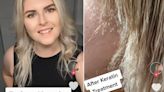 Woman has 'breakdown' after popular treatment 'melted off' her hair: 'It was done wrong'