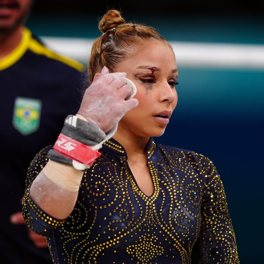 Olympics 2024: Brazilian Gymnast Flavia Saraiva Competes With Black Eye After Scary Fall - E! Online