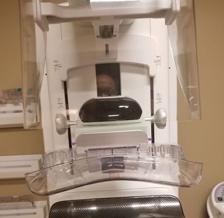 solis mammography plano