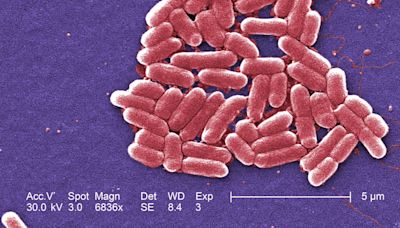 Legal action started against Tesco and Asda over E. coli outbreak