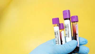 Panel recommends blood test to detect colon cancer for FDA approval