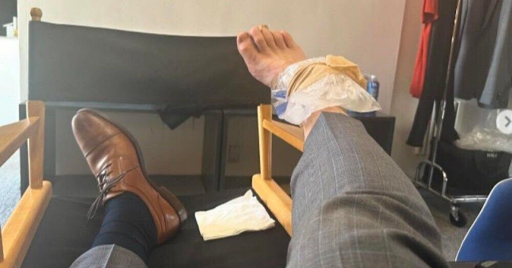 Chris Pratt injured shooting new movie