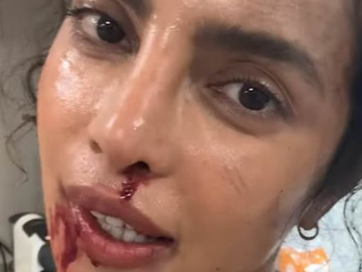 Priyanka Chopra is bruised and bloody for Russo brothers' The Bluff