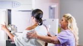 Breast cancer mammogram screenings should start at age 40 instead of 50, says health task force