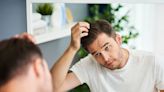 Dutasteride vs. Finasteride for Hair Loss: How Do They Compare?