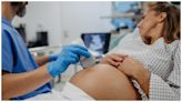 US has highest maternal mortality rate among wealthy nations: Study