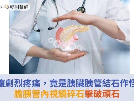 上腹劇烈疼痛，竟是胰臟胰管結石作怪！膽胰管內視鏡碎石擊破頑石 | 華人健康網 - 專業即時優質的健康新聞及資訊分享平台業即時優質的健康新聞及資訊分享平台