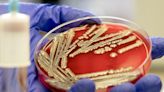 E. coli blamed on weather as food poisoning doubles