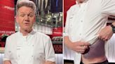 Gordon Ramsay Reveals Graphic Injury from Bike Accident: ‘Lucky to Be Here’