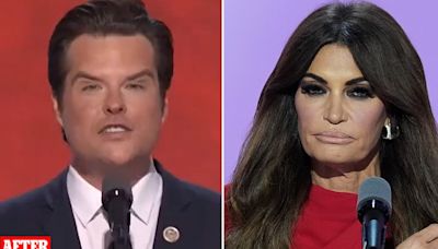 How plastic surgery was star of the show at RNC: Matt Gaetz