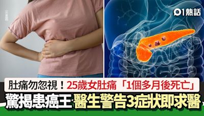 25歲女肚痛「1個多月後死亡」 驚揭患癌王 醫生警告3症狀即求醫