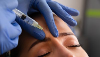 Behind the rise of ‘preventative Botox’ and how it’s changing young women