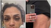 NBA player’s wife posts photos of her injuries after he turns himself in on domestic abuse charge