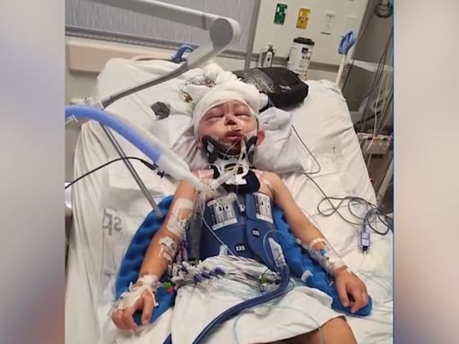 Child, 5, hospitalized in coma after hit by SUV while crossing street after school, family says