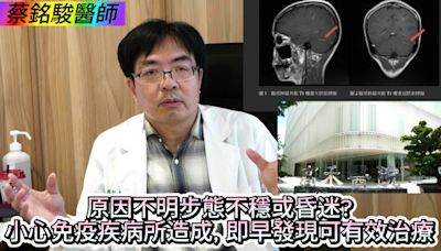 【影音】原因不明步態不穩或昏迷?良醫蔡銘駿：小心免疫疾病所造成, 即早發現可有效治療